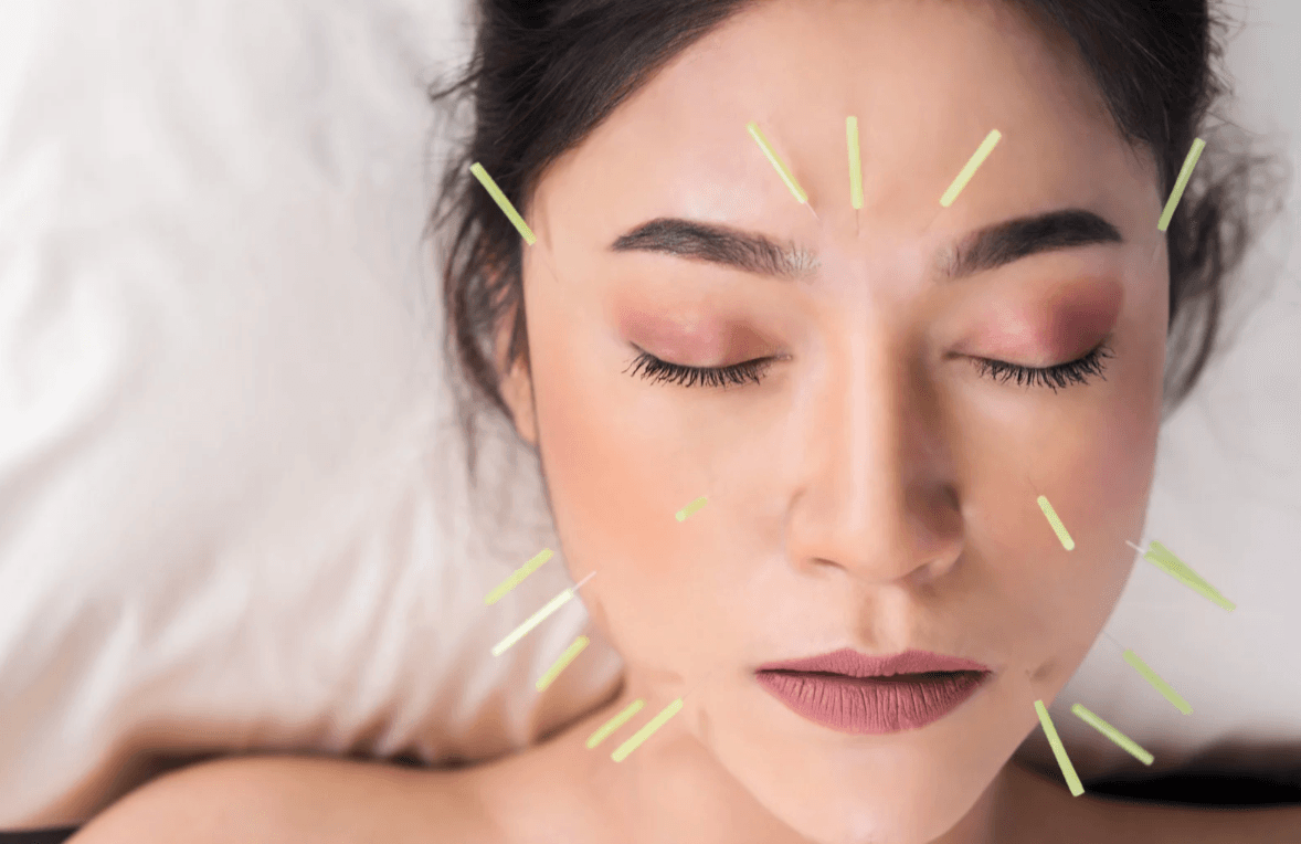 Facial Rejuvenation