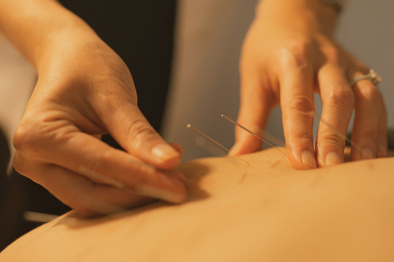 TAO Acupuncture and Integrative Medicine